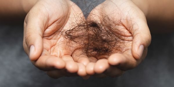What Causes hair loss